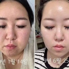 1 GÓI SERUM TINH CHẤT OHUI PRIME ADVANCER AMPOULE SERUM 1ML - OHUI