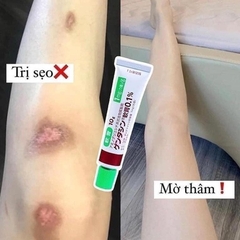 KEM TRỊ SẸO NHẬT BẢN 0.1% - GENTACIN