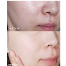 KEM DƯỠNG TRẮNG DA HUYẾT RỒNG LIANJI 30G GIÚP TRẮNG HỒNG GIẢM THÂM NÁM HIỆU QUẢ - GDN