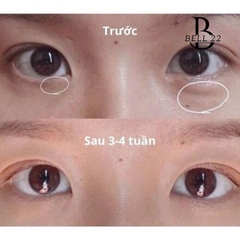 KEM MẮT COMPLIMENT PANTHENOL GIẢM THÂM BỌNG NHĂN MẮT B1031 - BELL22 STORE