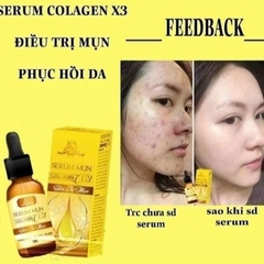 SERUM MỤN COLLAGEN X3 - HÀNG CHÍNH HÃNG CÔNG TY MỸ PHẨM ĐÔNG ANH KT1-GDN