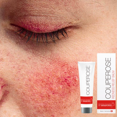 KEM PHỤC HỒI KÍCH ỨNG DA COUPEROSE 30ML - SWISSFORCE
