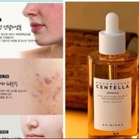 TINH CHẤT SKIN 1004 RAU MÁ GIẢM MỤN & PHỤC HỒI DA 100ML - SU