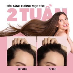 KEM Ủ TÓC BIOTIN & KERATIN CÔNG THỨC PHỤC HỒI TÓC CHUYÊN SÂU - DƯỠNG TÓC CHUẨN SPA 200GR (HŨ)-MILAGANICS