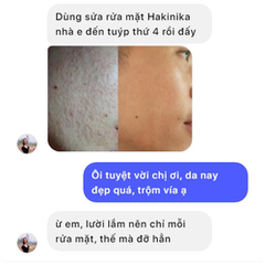 SỮA RỬA MẶT GIẢM MỤN, GIẢM THÂM SẠM, GIẢM NHỜN SẠCH SÂU HẠN CHẾ SẸO DO MỤN CHIẾT XUẤT THIÊN NHIÊN HAKINIKA- CHAI 80ML