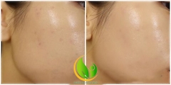 Serum Tinh chất dưỡng ẩm sâu Klairs Rich Moist Soothing