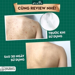 Sữa Tắm Some By Mi Giảm Mụn Cơ Thể, Làm Sạch Sâu-hàn