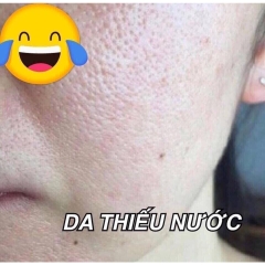 Serum OZ Filler Aqua 60ml-hàn