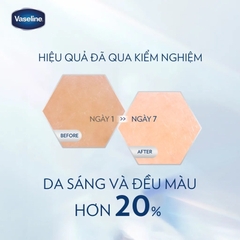 Sữa dưỡng thể Vaseline - Dạng Cha