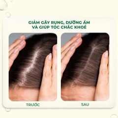 Tinh chất dưỡng tóc PURA D'OR Hair Thinning Therapy Energizing Scalp Serum organic, kích mọc tóc