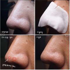 Mặt Nạ Đẩy Mụn Đầu Đen Ciracle Goodbye Blackhead (Miếng)-hàn