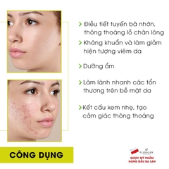 Kem dưỡng ẩm và kiểm soát dầu Floslek Anti Acne Mattifying Cream - 50ml-ba lan