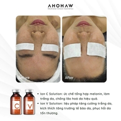 Vitamin C Ahohaw dạng bột Hàn Quốc, da sáng khỏe mịn màng