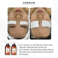 Tế Bào Gốc Phục Hồi Da AHOHAW IONS V (20ml/ Lọ)