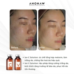 Tế Bào Gốc Phục Hồi Da AHOHAW IONS P (20ml/ Lọ)