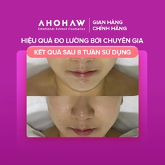 Tế Bào Gốc Phục Hồi Da AHOHAW IONS P (20ml/ Lọ)
