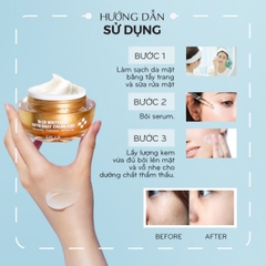 Kem Ngày Trắng Da Mờ Nám Tế Bào Gốc DR.LB Cao Cấp Hàn Quốc