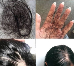 TINH CHẤT NƯỚC XỊT MỌC TÓC NGĂN NGỪA RỤNG TÓC HÓI ĐẦU MBA-hàn