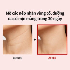 Kem Dưỡng Chống Lão Hóa Vùng Cổ Medi-Pee-hàn