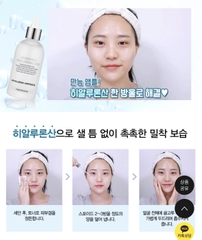 Serum Cấp Ẩm Căng Bóng Da Hyaluronic Ampoule Hàn Quốc