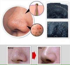 GEL LỘT MỤN KOSE _Gel 25g Nhật Bản