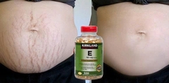 Viên uổng bổ sung Vitamin E 400 IU KirklLAND-500 viên Mỹ