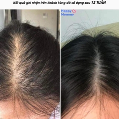 Viên Uống Hỗ Trợ Mọc Tóc Merz Spezial Nội Địa Đức, 120 Viên
