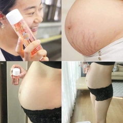 Tinh Dầu Trị Rạn Da Bio-Oil Nội Địa Úc, 60Ml