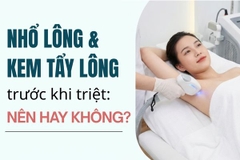 Nhổ lông và kem tẩy lông trước khi triệt: Nên hay không?