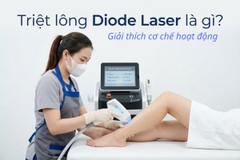 Triệt lông Diode Laser là gì? Giải thích cơ chế hoạt động