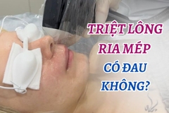 Triệt lông ria mép có đau không? Cảm giác thực tế không đáng sợ như bạn nghĩ