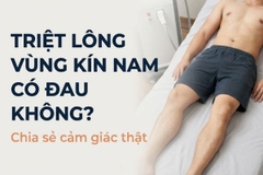 Triệt lông vùng kín nam có đau không? Chia sẻ cảm giác thật