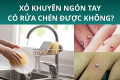 Xỏ khuyên ngón tay có rửa chén được không?