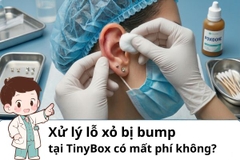 Xử lý lỗ xỏ bị bump tại TinyBox có mất phí không?
