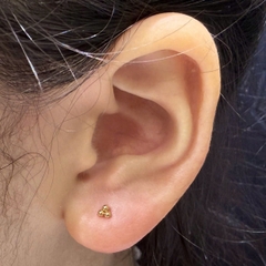 Bông tai 3 bi màu vàng thép không gỉ 316L - 2 size