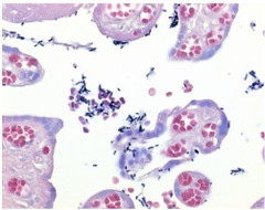 Lugol's solution stabilized with PVP for the Gram staining