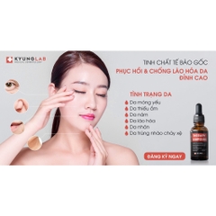 Serum tế bào gốc chống lão hoá, phục hồi da PDRN Kyung Lab