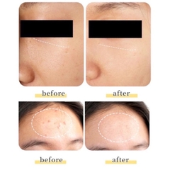 Tinh chất huyết tương EVENSWISS REGENERATING PLASMA