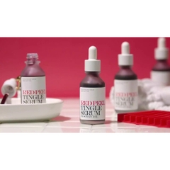 Tinh Chất Tẩy Da Chết Hóa Học So' Natural Red Peel Tingle Serum 35ml