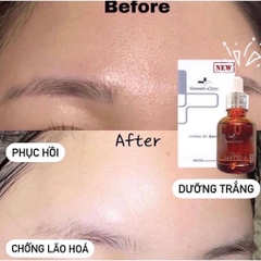 Serum Cấp Ẩm Phục Hồi Da Hydra B5 Serum GoodnDoc 30ml