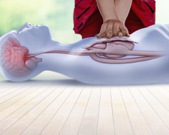 CPR là gì? Mua mô hình thực hành hồi sức tim phổi ở đâu?