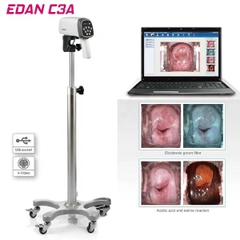 MÁY SOI CỔ TỬ CUNG EDAN C3A