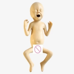 MÔ HÌNH CHĂM SÓC TRẺ SƠ SINH THIẾU THÁNG