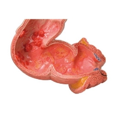 Mô Hình Ruột Già – 1008496 – 3B Scientific