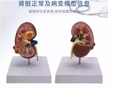 Mô hình bệnh lý thận, Mô hình thực hành bệnh lý thận