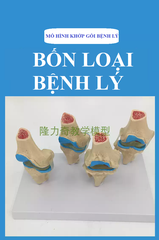 MÔ HÌNH GIẢNG DẠY BỆNH LÝ KHỚP GỐI