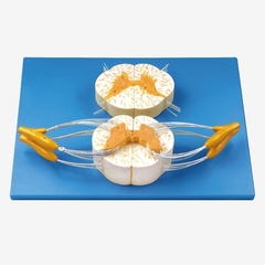 MÔ HÌNH CẮT NGANG TỦY SỐNG CÓ CÁC DÂY THẦN KINH GD/A18103