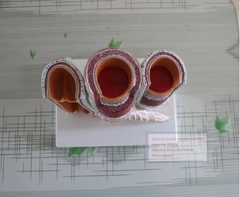 MÔ HÌNH CẤU TẠO THÀNH MẠCH