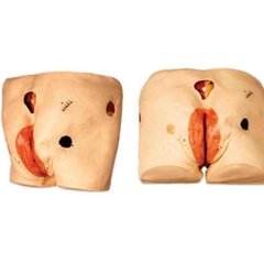 MÔ HÌNH CHĂM SÓC VẾT THƯƠNG