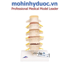 MÔ HÌNH CỘT SỐNG – 1000158 – 3B SCIENTIFIC